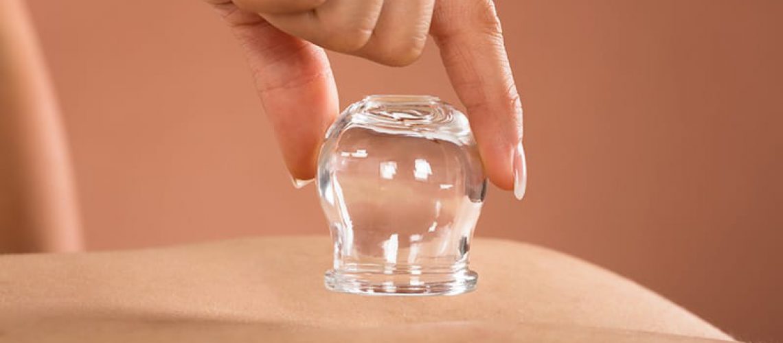 Close-up Of A Therapist Hand Giving Cupping Treatment In Spa